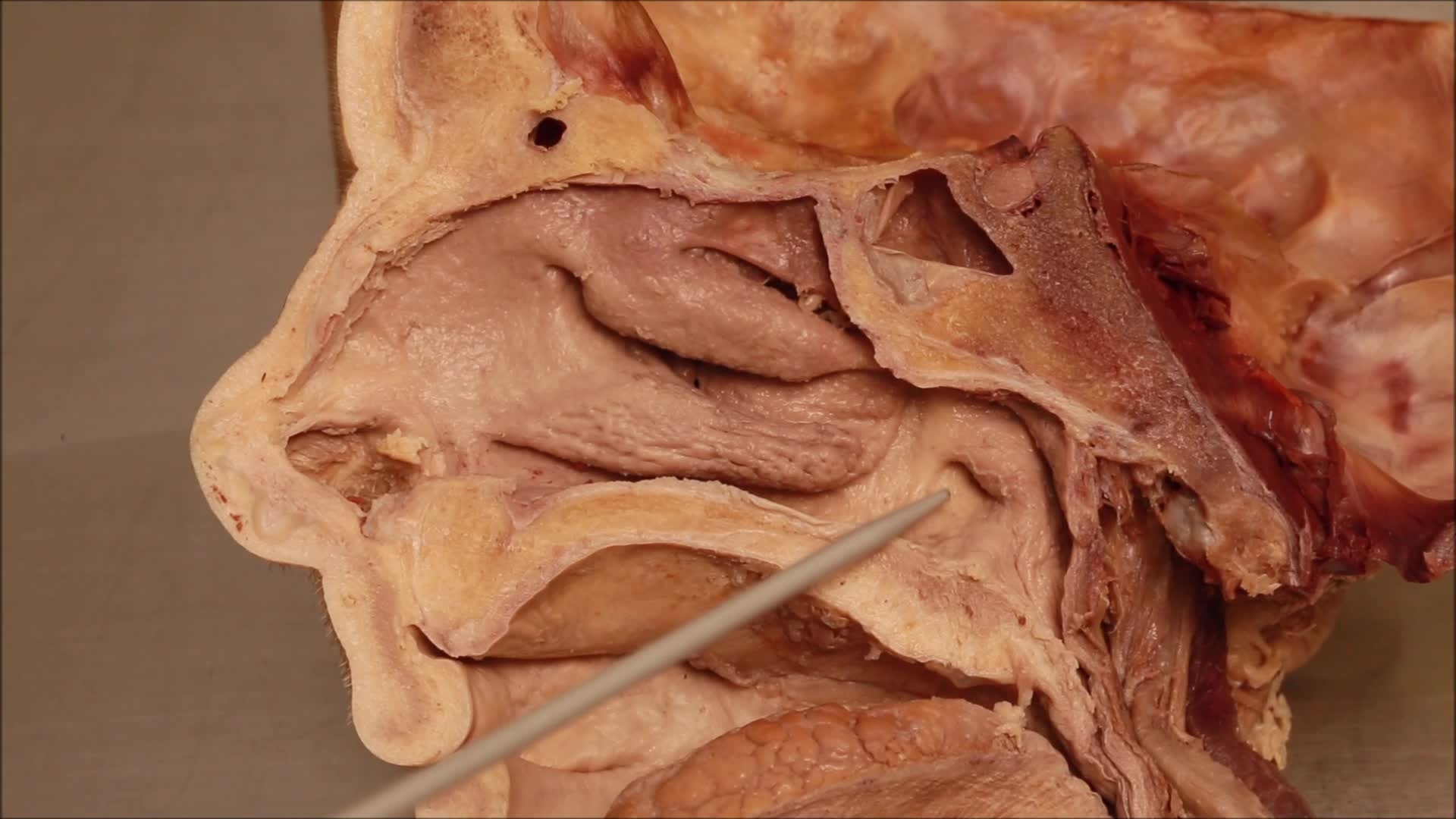 15 G Openings Into The Nasal Cavity The University Of Sheffield Kaltura Digital Media Hub