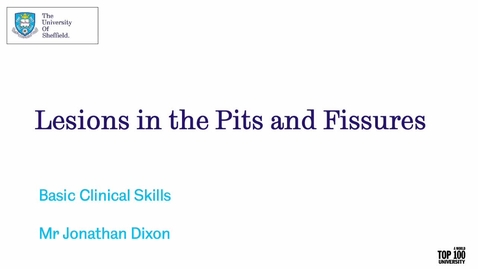 Thumbnail for Lesions in the Pits and Fissures