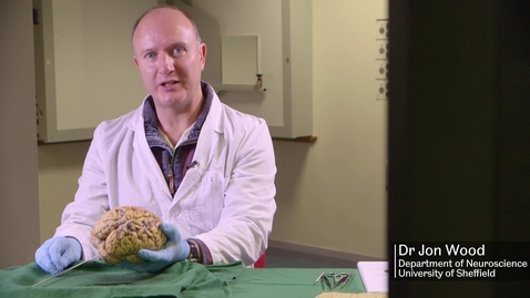 Thumbnail for General overview of the brain