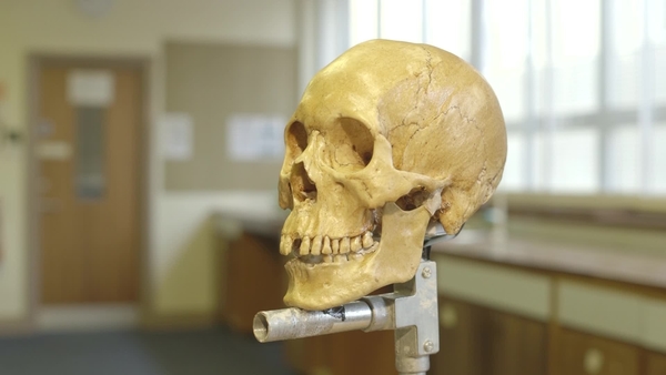 Forensic Facial Reconstruction timelapse