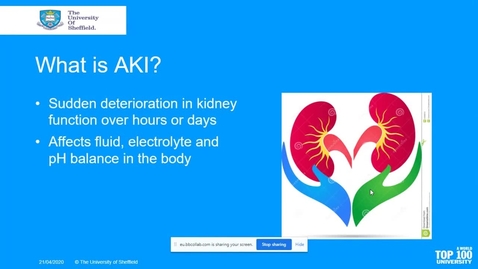 Thumbnail for entry Acute Kidney Injury And Fluid Balance-V2