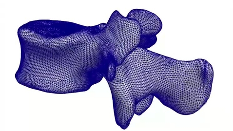 Thumbnail for ESR5-vertebra2