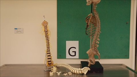 Thumbnail for Musculoskeletal Station G.mp4
