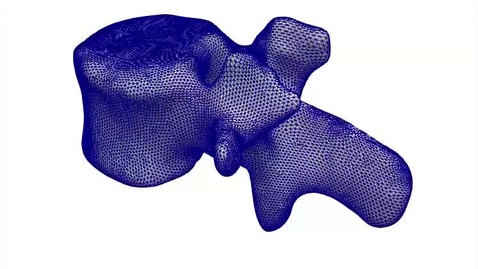 Thumbnail for ESR5-vertebra3