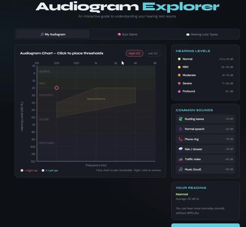 Interactive Audiogram with Quiz by Ms. A. Advocacy | TPT