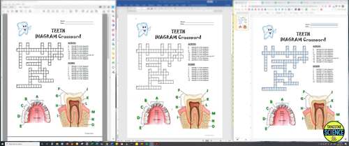 Teeth Crossword with Diagram Editable Printable Distance Learning