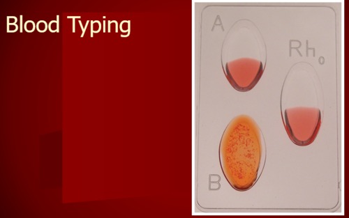 Preview of Simulated Blood Typing Lab Bundle