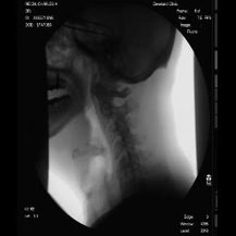 Blood vessel model for contrast medium - Accessories - X-ray